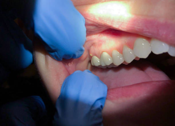 Best Urgent Dental Care for Toothache in Longtown, OK