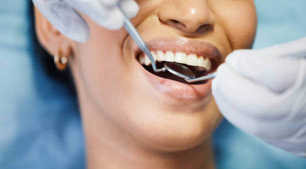 Best Emergency Dental Care for Abscessed Tooth in Longtown, OK