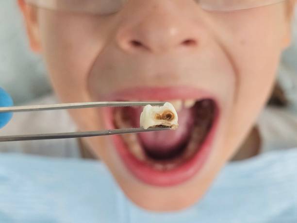 Best Emergency Dental Services for Seniors in Longtown, OK